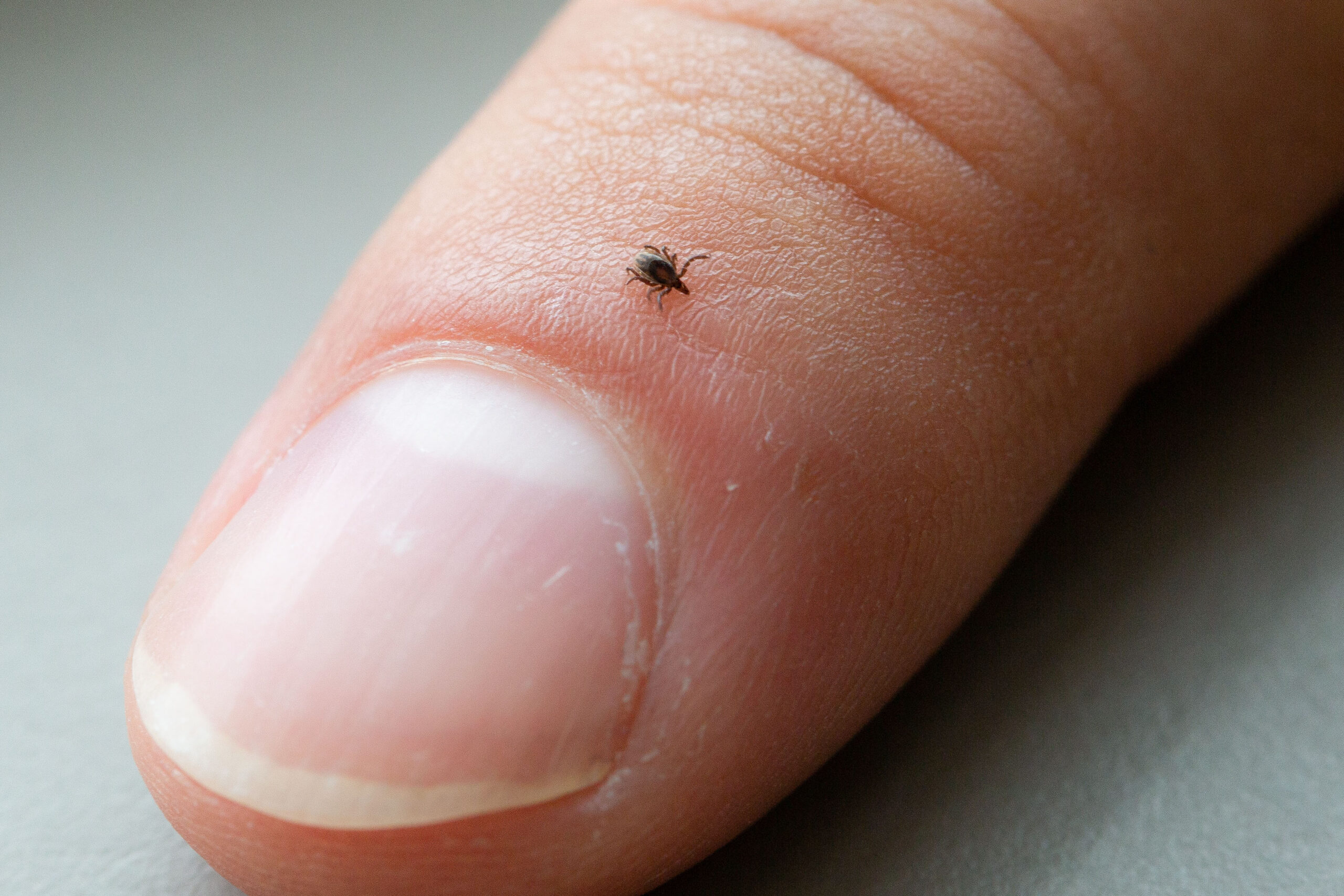 Ticks And Lyme Disease